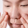 Kép 2/3 - MIZON Good Bye Blemish bőrnyugtató tapasz pattanásos bőrre